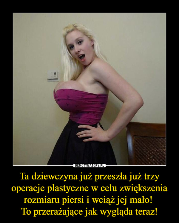 Ta dziewczyna już przeszła już trzy operacje plastyczne w celu zwiększenia rozmiaru piersi i wciąż jej mało! To przerażające jak wygląda teraz! –  