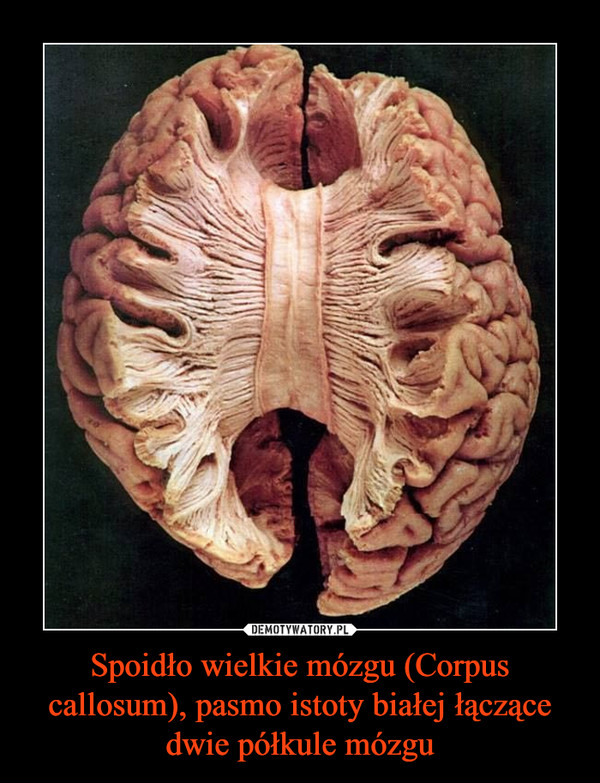 Spoidło wielkie mózgu (Corpus callosum), pasmo istoty białej łączące dwie półkule mózgu –  