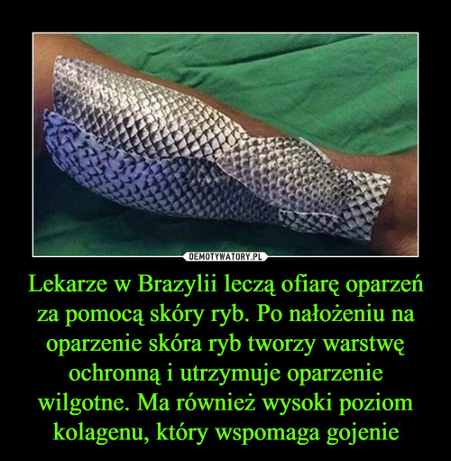 Lekarze w Brazylii leczą ofiarę oparzeń za pomocą skóry ryb. Po nałożeniu na oparzenie skóra ryb tworzy warstwę ochronną i utrzymuje oparzenie wilgotne. Ma również wysoki poziom kolagenu, który wspomaga gojenie