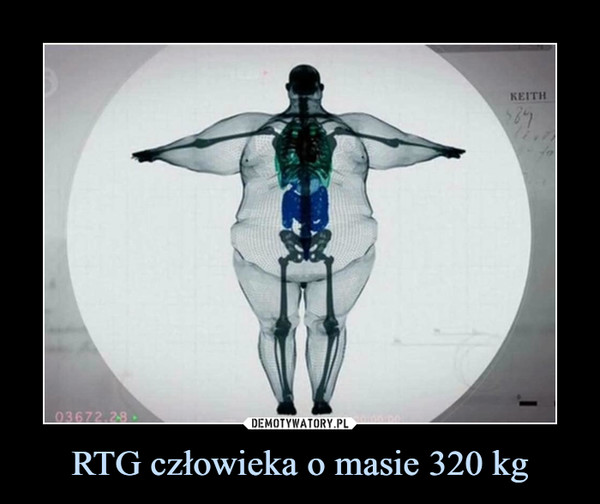 RTG człowieka o masie 320 kg –  