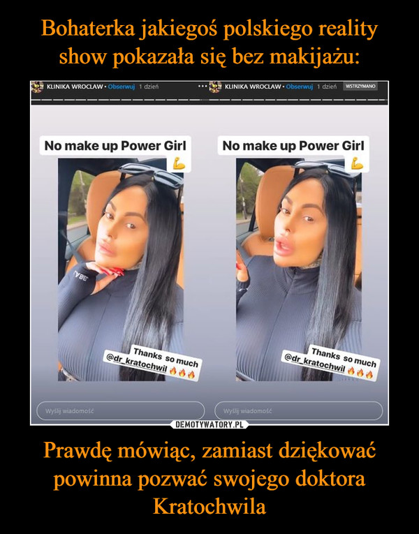 Bohaterka jakiegoś polskiego reality show pokazała się bez makijażu: Prawdę mówiąc, zamiast dziękować powinna pozwać swojego doktora Kratochwila