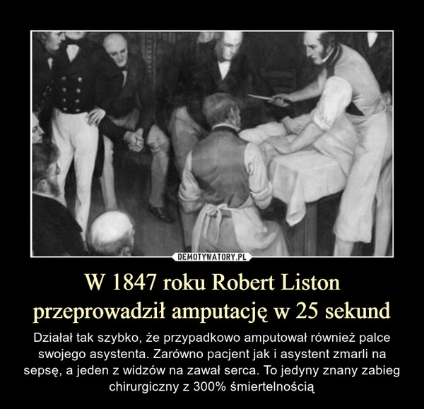 W 1847 roku Robert Liston przeprowadził amputację w 25 sekund