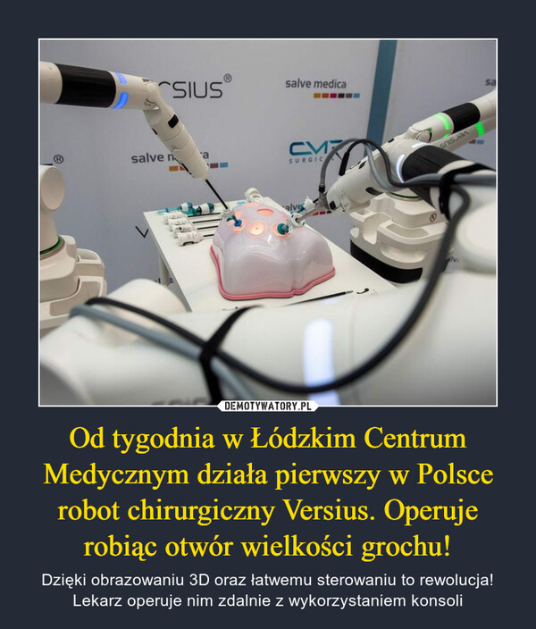 Od tygodnia w Łódzkim Centrum Medycznym działa pierwszy w Polsce robot chirurgiczny Versius. Operuje robiąc otwór wielkości grochu!