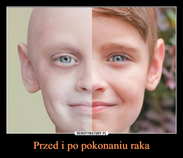 Przed i po pokonaniu raka