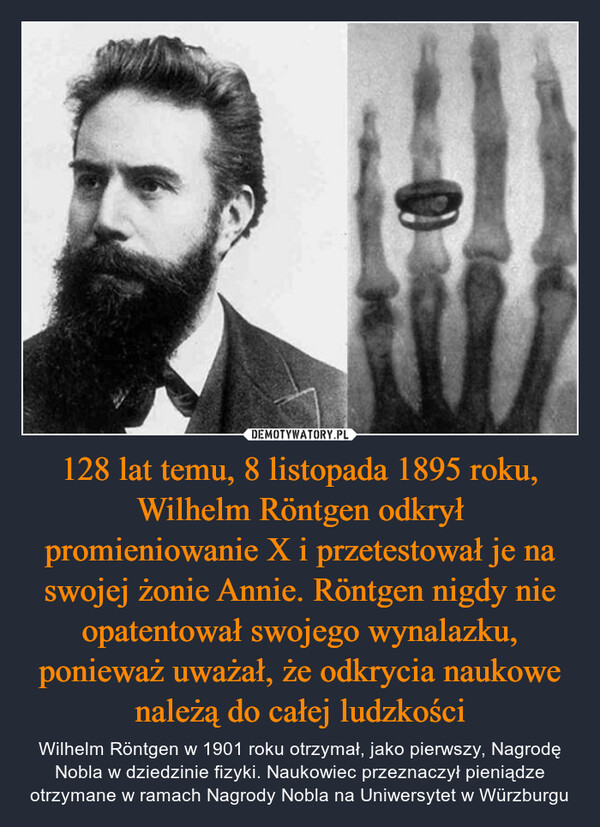 128 lat temu, 8 listopada 1895 roku, Wilhelm Röntgen odkrył promieniowanie X i przetestował je na swojej żonie Annie. Röntgen nigdy nie opatentował swojego wynalazku, ponieważ uważał, że odkrycia naukowe należą do całej ludzkości – Wilhelm Röntgen w 1901 roku otrzymał, jako pierwszy, Nagrodę Nobla w dziedzinie fizyki. Naukowiec przeznaczył pieniądze otrzymane w ramach Nagrody Nobla na Uniwersytet w Würzburgu 